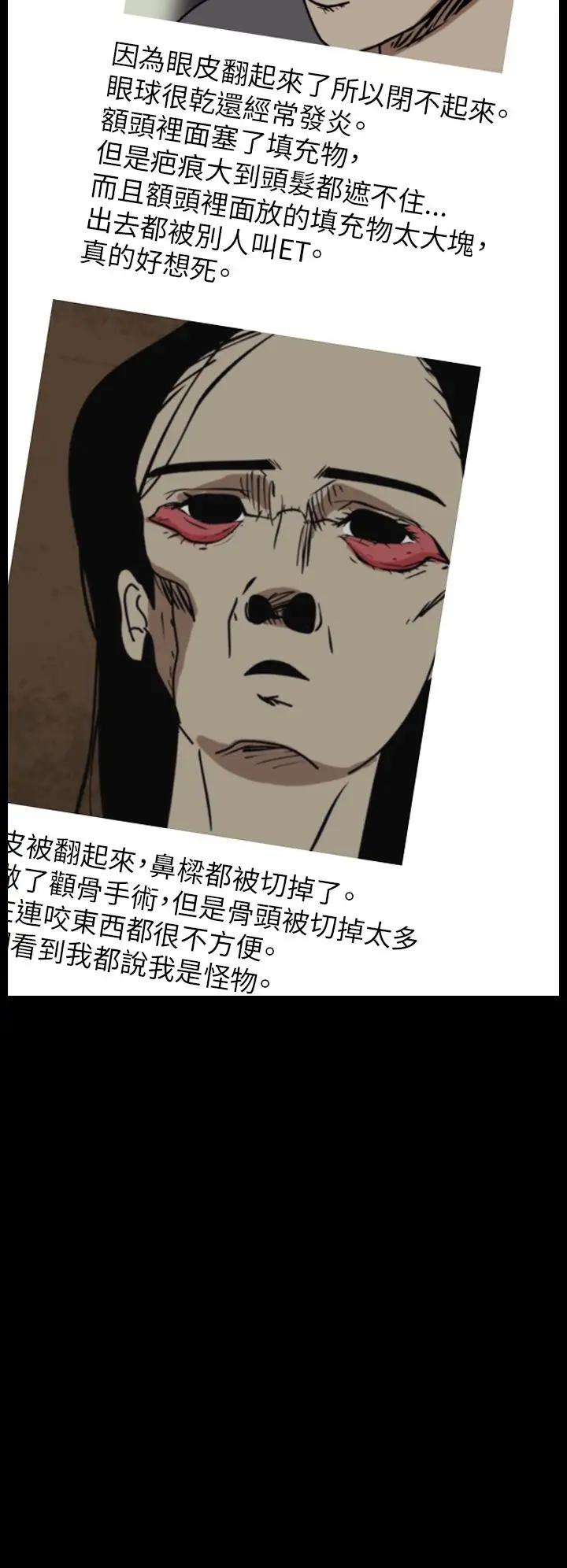 恐怖秀第45话整形鬼3